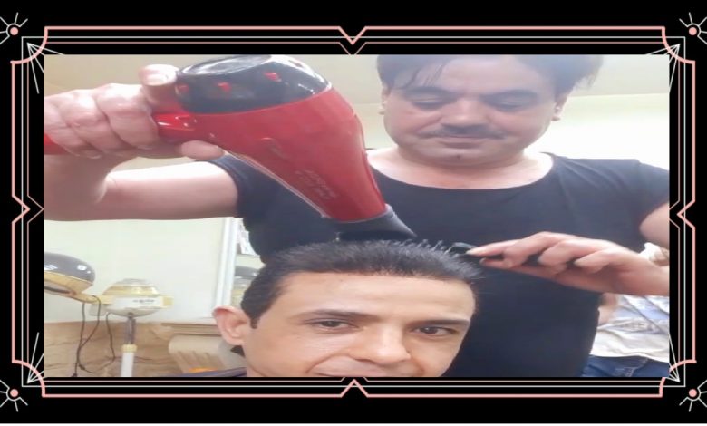 صورة بدر عياد يخضع لعملية زراعة شعر شاملة بواسطة الخبير العالمي جلال عبد الحميد